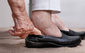 Unngå væskeansamling, her har du noen tips til hvordan