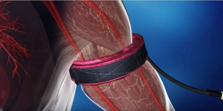 Okklusjonstrening er ikke farlig i seg selv, men noen risikogrupper må ta forholdsregler.