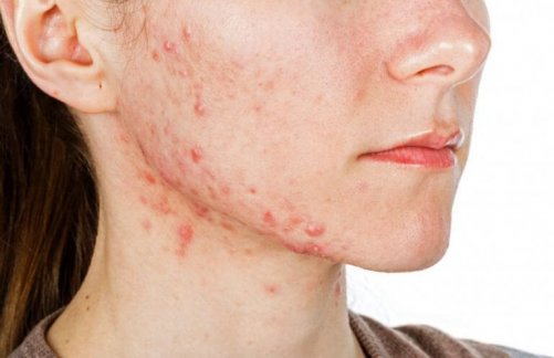 C-vitamin er flott for huden