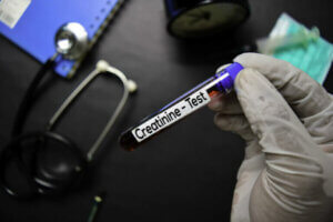 Er et høyt nivå av kreatinin skadelig for helsen din?