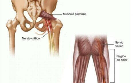 Piriformis-muskelen.